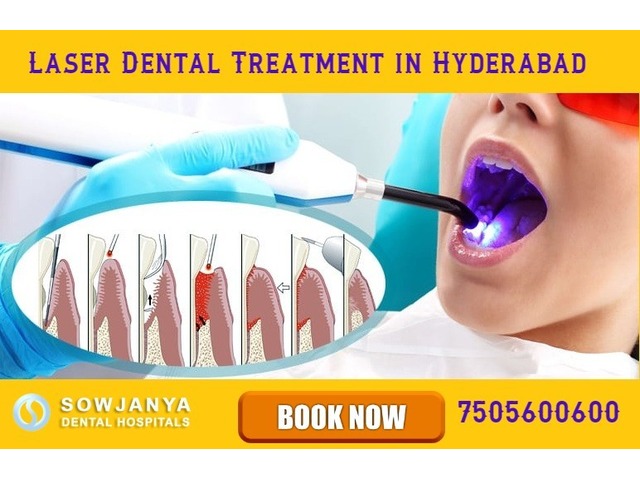 Laser Dental Treatment in Hyderabad - 1